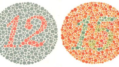 Colour blindness: a hidden vision condition many don’t realise they have